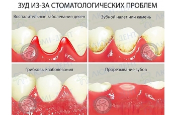 чешется десна фото ЛюмиДент