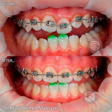 Dentistry «Lumi-Dent» in Kyiv
