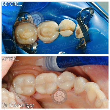 Dentistry «Lumi-Dent» in Kyiv