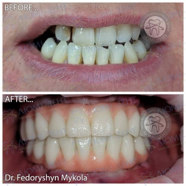 Dentistry «Lumi-Dent» in Kyiv