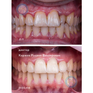 стоматолог-ортодонт Коржев Р. В. Киев