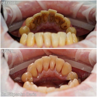 Стоматологія «Люмі-Дент» в Києві