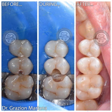 стоматолог-терапевт Гразион Марьяна