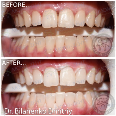 Dentistry Lumi-Dent in Kyiv