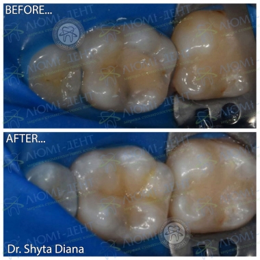 Dentistry «Lumi-Dent» in Kyiv