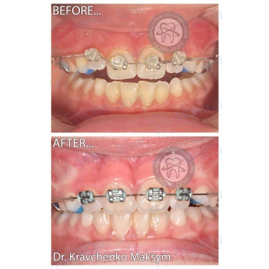 Dentistry «Lumi-Dent» in Kyiv