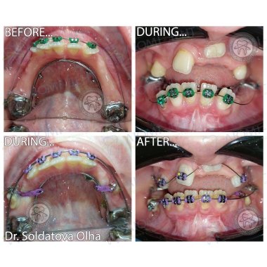 стоматолог-ортодонт Солдатова Ольга