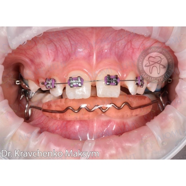 Dentistry «Lumi-Dent» in Kyiv