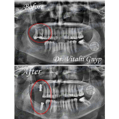 Dentistry Lumi-Dent in Kyiv