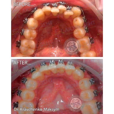 Dentistry «Lumi-Dent» in Kyiv