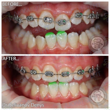 Dentistry «Lumi-Dent» in Kyiv