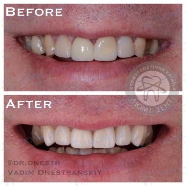 Dentistry Lumi-Dent in Kyiv