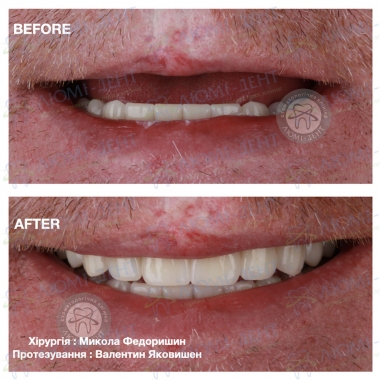 Dentistry «Lumi-Dent» in Kyiv