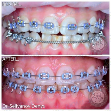 Dentistry «Lumi-Dent» in Kyiv