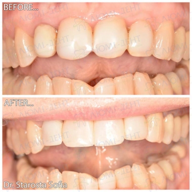 Примеры работ доктора Староста С.Б.