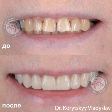 Стоматология Люми-Дент в Киеве