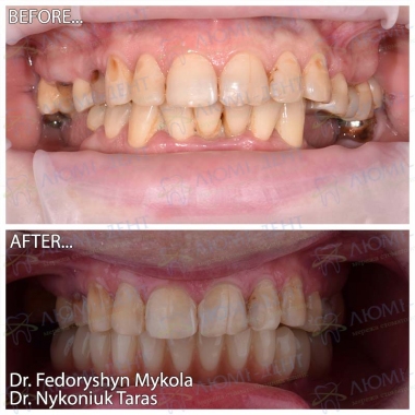 Dentistry «Lumi-Dent» in Kyiv