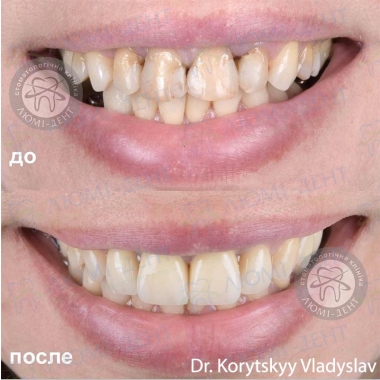 Dentistry Lumi-Dent in Kyiv