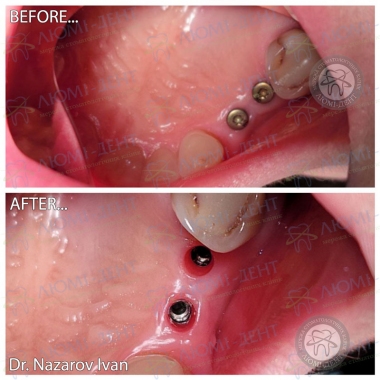 Dentistry «Lumi-Dent» in Kyiv