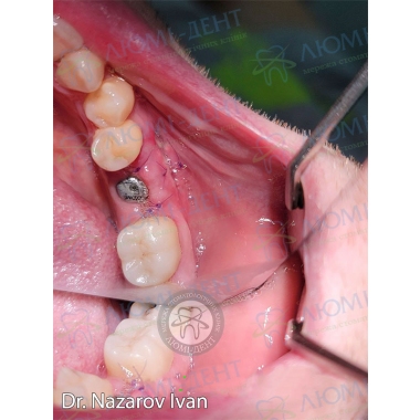 Dentistry «Lumi-Dent» in Kyiv