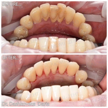 Dentistry «Lumi-Dent» in Kyiv