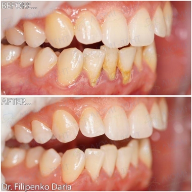 Стоматологія «Люмі-Дент» в Києві