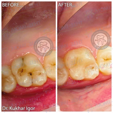 Dentistry «Lumi-Dent» in Kyiv