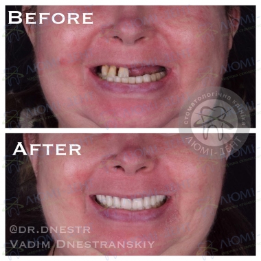 Dentistry Lumi-Dent in Kyiv