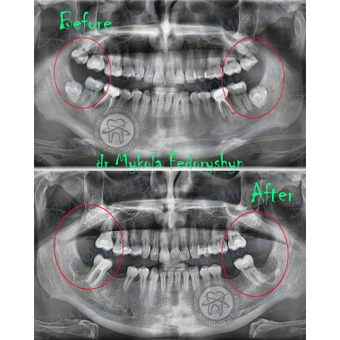 Dentistry Lumi-Dent in Kyiv