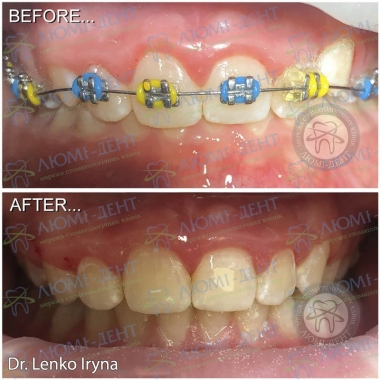 Dentistry «Lumi-Dent» in Kyiv