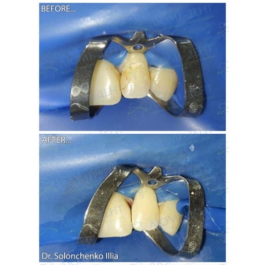 Dentistry «Lumi-Dent» in Kyiv