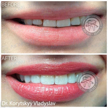 Dentistry Lumi-Dent in Kyiv