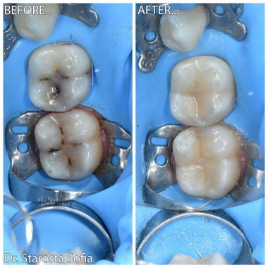 Примеры работ доктора Староста С.Б.