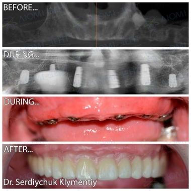 примеры работ хирург Сердийчук Климентий