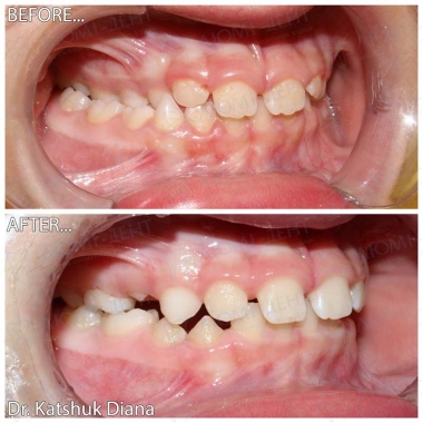 Dentistry «Lumi-Dent» in Kyiv Dentistry «Lumi-Dent» in Kyiv