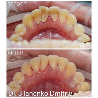 Dentistry Lumi-Dent in Kyiv