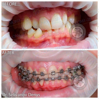 Dentistry «Lumi-Dent» in Kyiv