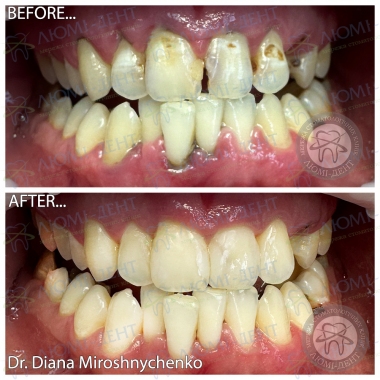 Dentistry Lumi-Dent in Kyiv