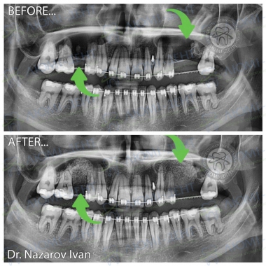 Dentistry «Lumi-Dent» in Kyiv