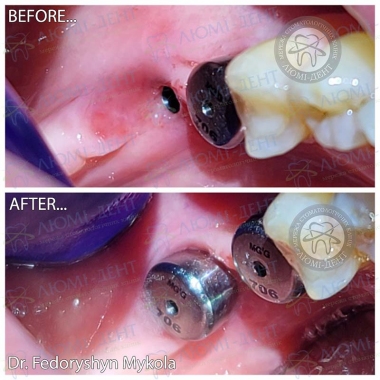 Dentistry «Lumi-Dent» in Kyiv