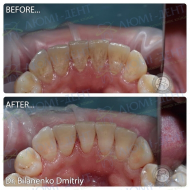 Dentistry Lumi-Dent in Kyiv