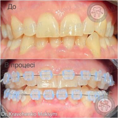 Dentistry «Lumi-Dent» in Kyiv