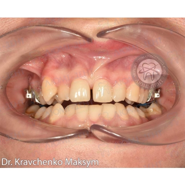 Dentistry «Lumi-Dent» in Kyiv