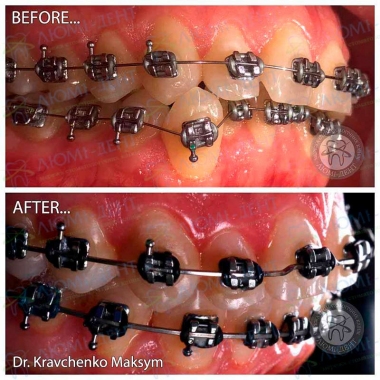 Dentistry «Lumi-Dent» in Kyiv