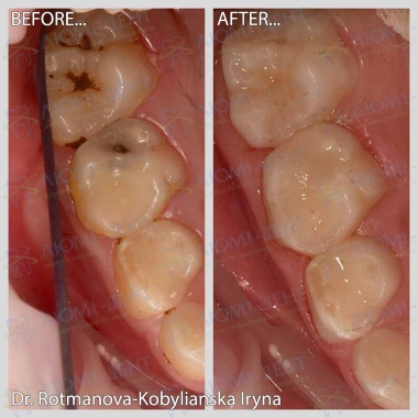 Примеры работ доктора  Ротманова - Кобылянская И. А