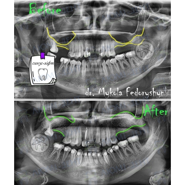 Dentistry Lumi-Dent in Kyiv