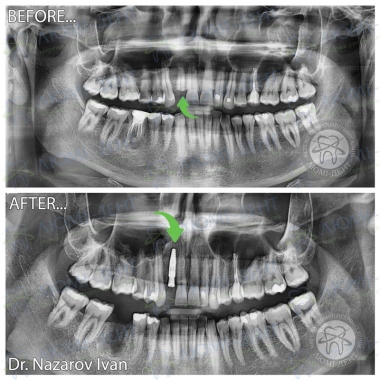 Dentistry «Lumi-Dent» in Kyiv