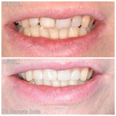 Врач стоматолог-терапевт Староста С.Б.