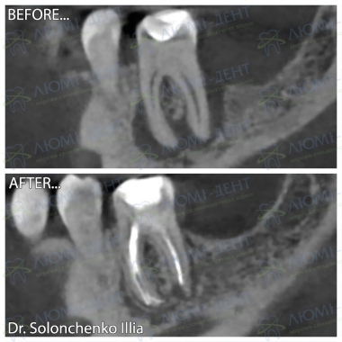 Dentistry «Lumi-Dent» in Kyiv