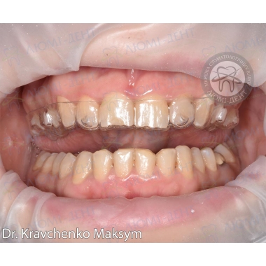 Dentistry «Lumi-Dent» in Kyiv